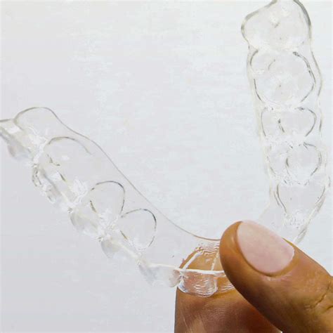 Clear Braces Surrey .